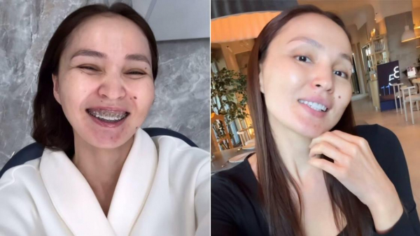 "Принимаю поздравления": Жулдыз Абдукаримова сняла брекеты (видео)