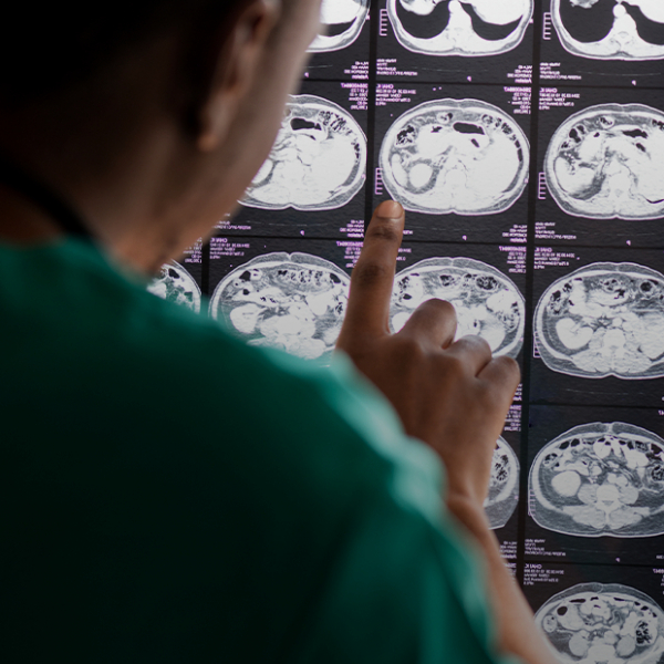 «Мозг — это как космос, скрытый в черепе»